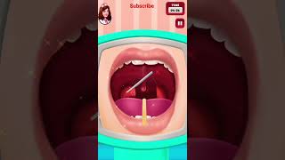 tonsils removed Doctor treatment gameplay short video Android gaming short video