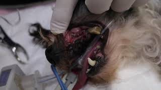 Dr Mike performs full mouth teeth extractions