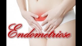 A minha endometriose - Parte 2