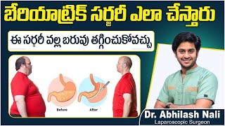 Process Of Bariatric Surgery || Best Treatment For Weight Loss || Dr Abhilash Nali