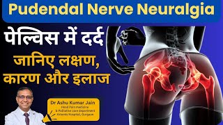 Pelvic Pain & Pudendal Nerve Neuralgia (Hindi)/ जानिए लक्षण, कारण और इलाज | पेल्विस में दर्द