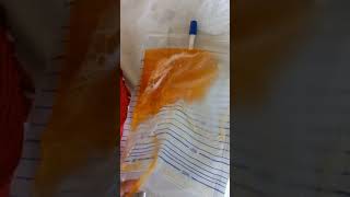 Orange colour urine! when found?