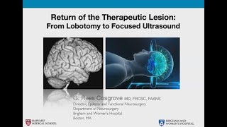 Return of the therapeutic lesion: From lobotomy to focused ultrasound: Presented by Rees Cosgrove.