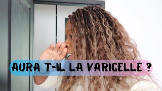 ✔️356 [VLOG FAMILLE] AURA T-IL LA VARICELLE ?