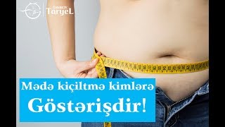 Mədə kiçiltmə Bariatrik cərrahiyyə kimlərə göstərişdir  Ph D  Taryel Omerov