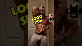 How I have no loose skin #weightlossjourney #extremeweightloss  #looseskin #motivation #weightloss