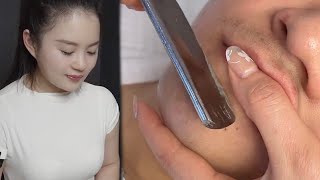 💈ASMR | Remove dead skin from a man's face. Facial care. 🪒 Wonderful shave !