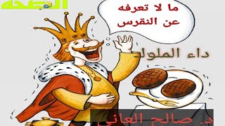 هل ارتفاع حمض البول هو سبب هجمات النقرس ؟