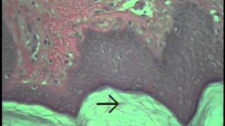 Histology of Integument