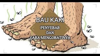 Penyebab Bau Kaki dan Cara Mengobatinya