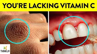 8 Signs Your Body Is Begging for Vitamin C