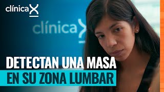 Beatriz presenta un tumor en la parte superior de su espalda | Clínica X