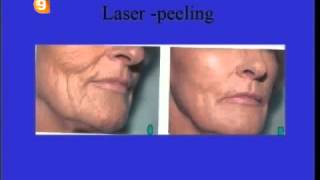 ΜΗ ΕΠΕΜΒΑΤΙΚΗ ΠΛΑΣΤΙΚΗ ΧΕΙΡΟΥΡΓΙΚΗ: Lipofilling, Botox, Laser Peeling