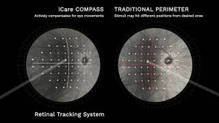 iCare COMPASS perimeter