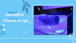 All About Jaundice  - First Hilamos and Ligo of our Baby- #vlog7 #BuhayOFW