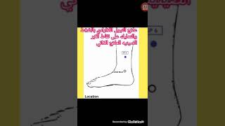 علاج التبول اللاارادي بالضغط والتدليك على نقاط الابر الصينيه العلاج الذاتي