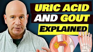 Uric Acid Levels and Gout Explained: Impact of Carnivore/Ketogenic Diet on Them!