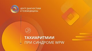 Тахиаритмии при синдроме WPW