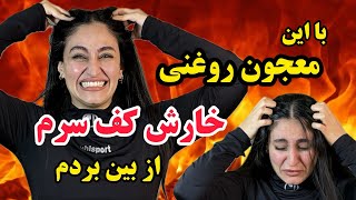 معجون روغنی که خارش کف سرم رو از بین برد😌درمان خارش کف سرم فقط این معجون روغنیه😍