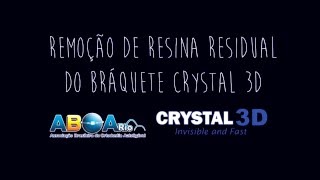 Remoção da resina residual do Bráquete Crystal 3D