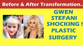 Gwen Stefani Plastic Surgery Before and After Full HD