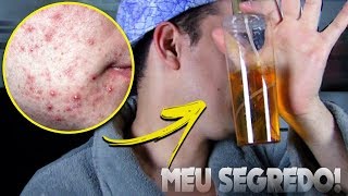 O MILAGRE DA PELE PERFEITA | gutierreoficial