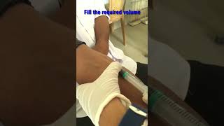 Venous blood collection ll Open system of blood collection ll #shorts ll #trending #laboratory