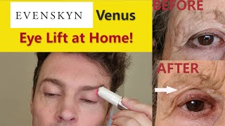 EvenSkyn Venus - Lifting & Skin Tightening for Eyes! Full 3 week review