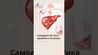 САМОДИАГНОСТИКА ПРОБЛЕМ С ПЕЧЕНЬЮ #печень #здоровьепечени #гепатоз #гепатозпечени