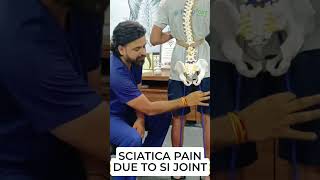 SCIATICA PAIN | DUE TO SI JOINT DYSFUNCTION  #drsunilphysio #backpain #hacks