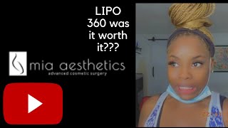 My LIPO 360 Journey Part 1|MIA AESTHETICS| Dr. Lauren Wright IS IT REALLY WORTH IT???