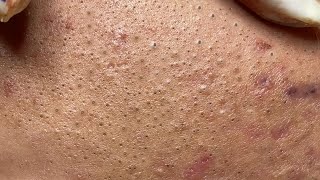 Satisfying Hien Spa Beauty Relaxing Video #28