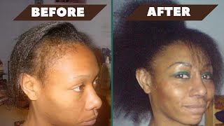 My weave-damaged hair wouldn't grow until I did THIS | Opt into Beauty