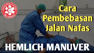 Pembebasan sumbatan jalan nafas - Hemlich Manuver