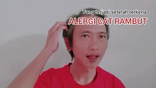 apa yang terjadi setelah terkena alergi cat rambut | efek setelah terkena alergi cat rambut