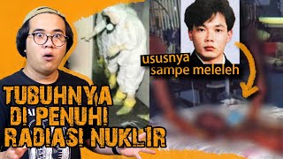 TUBUHNYA DI PENUHI RADIASI NUKLIR, SAMPE KAYAK GINI KONDISINYA SEREM PARAH !!!