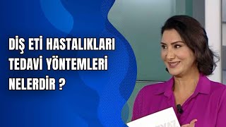 Diş Eti Hastalıkları Tedavi Yöntemleri Nelerdir?