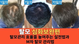 탈모관리 효율을 높여주는 실전법과 M자 탈모 관리법을 공개합니다!