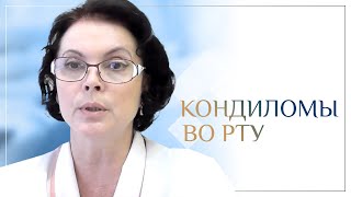 Кондиломы во рту