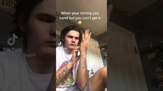 TikTok | Itchy hand