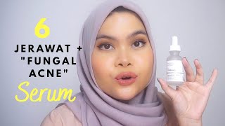 Skincare Fungal Acne #6: Serum Bagus Andalan!