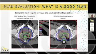 IMRT 2.0 | Session 18 | IMRT Treatment Planning: What is a good plan?