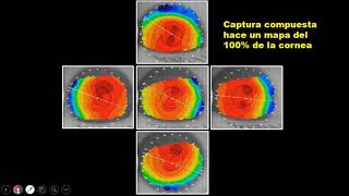 Que tan necesario es un topografo en la practica privada y como sacarle el mejor provecho