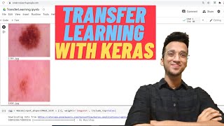 Transfer Learning Using CNN(VGG 16)| Keras Tutorial|