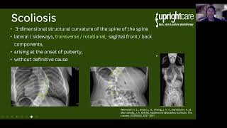 Screening for Scoliosis