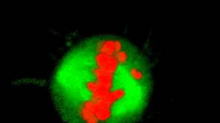 Mitosis in 3D - With Chromosome Bridge