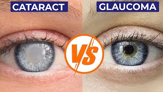 Mahavir International Delhi- Biggest Difference Between Cataract and Glaucoma | Cataract vs Glaucoma