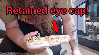 Dealing with Burmese python retained eye cap.