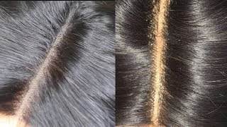 HOW TO GET RID OF THE GRID LINES ON A CLOSURE| MAXINE ALIEXPRESS HAIR