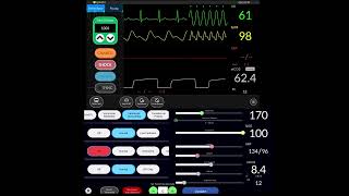 Simpl patient monitor APP demonstration (How to use simple monitor app)